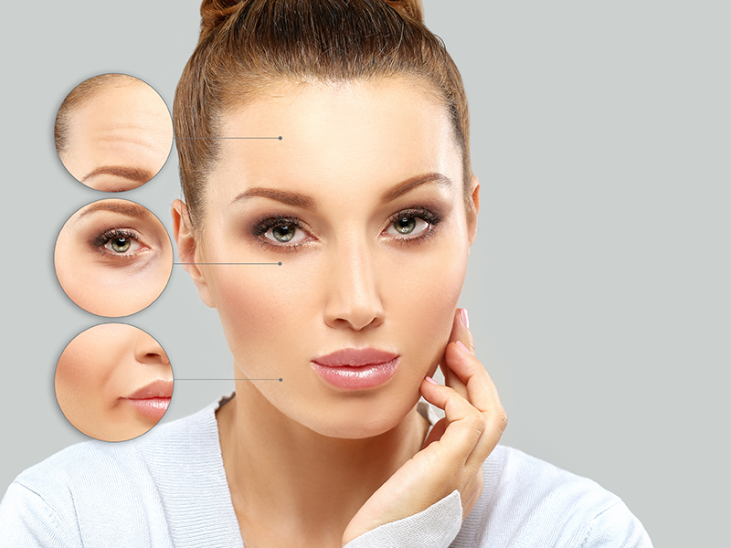 Botox Botox