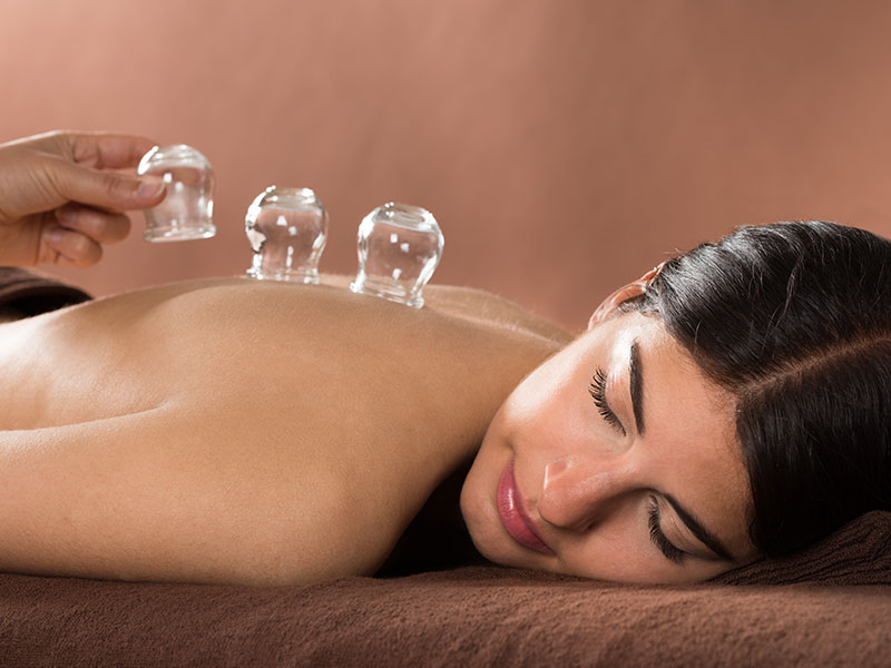 Body Cupping Body Cupping